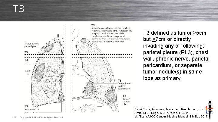T 3 defined as tumor >5 cm but <7 cm or directly invading any