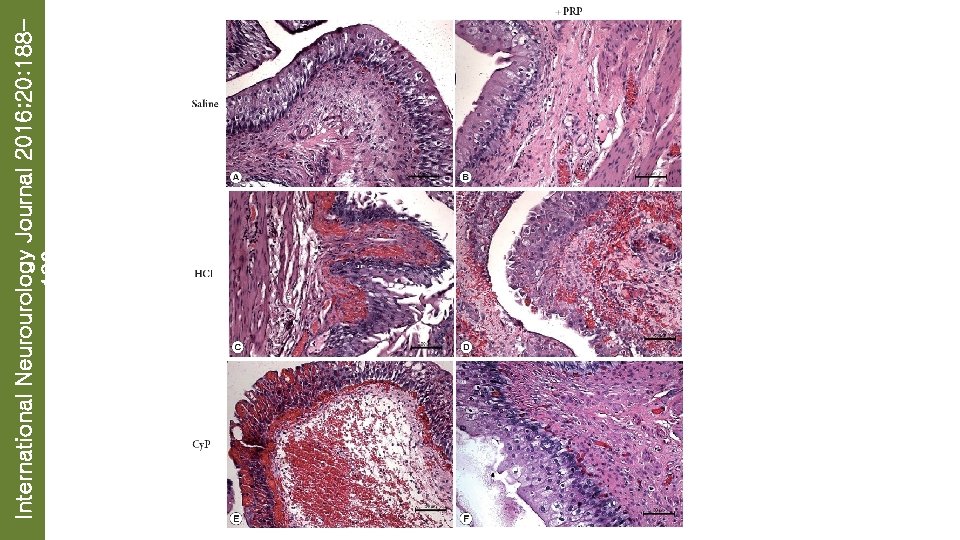 International Neurourology Journal 2016; 20: 188196 