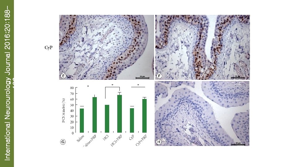 International Neurourology Journal 2016; 20: 188196 