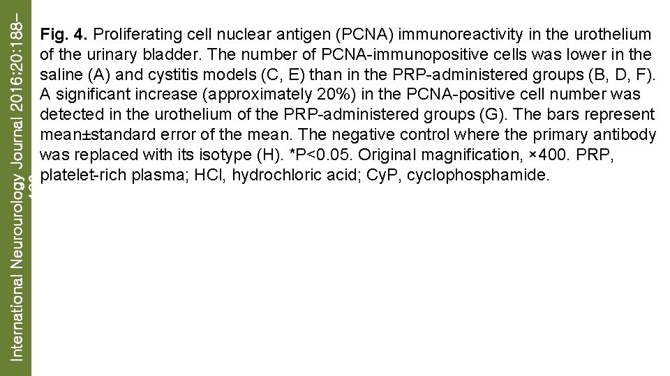 International Neurourology Journal 2016; 20: 188196 Fig. 4. Proliferating cell nuclear antigen (PCNA) immunoreactivity