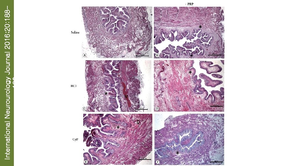 International Neurourology Journal 2016; 20: 188196 