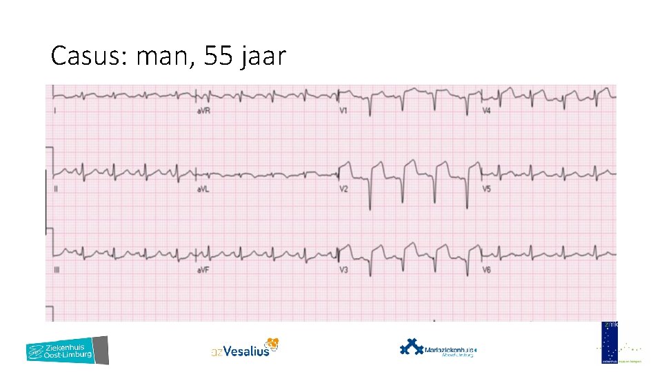 Casus: man, 55 jaar 