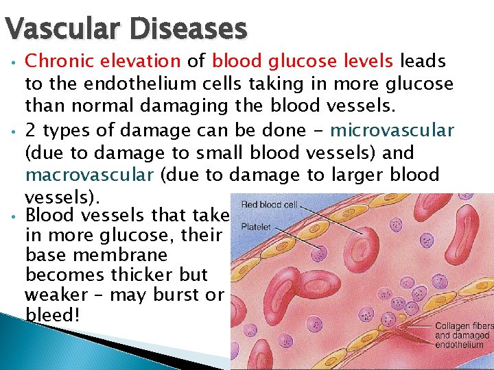 Vascular Diseases • • • Chronic elevation of blood glucose levels leads to the