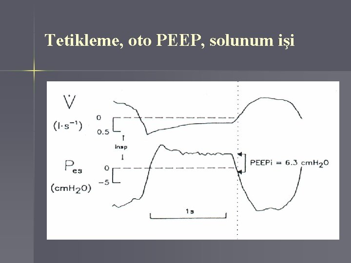 Tetikleme, oto PEEP, solunum işi 