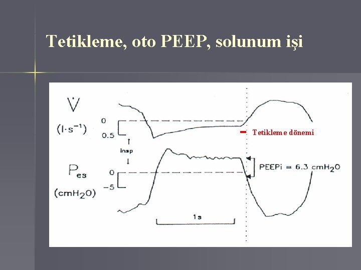 Tetikleme, oto PEEP, solunum işi Tetikleme dönemi 