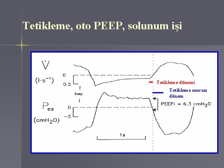 Tetikleme, oto PEEP, solunum işi Tetikleme dönemi Tetikleme sonrası dönem 