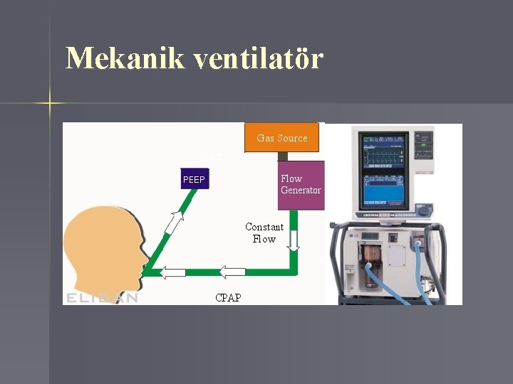 Mekanik ventilatör 