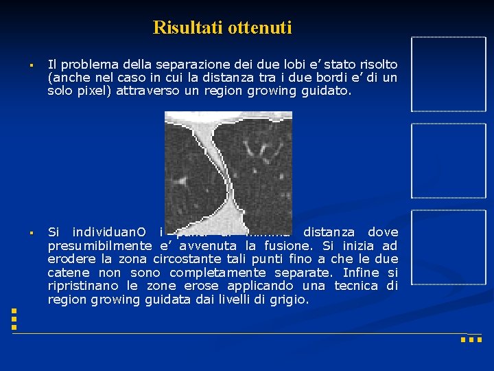 Risultati ottenuti § Il problema della separazione dei due lobi e’ stato risolto (anche