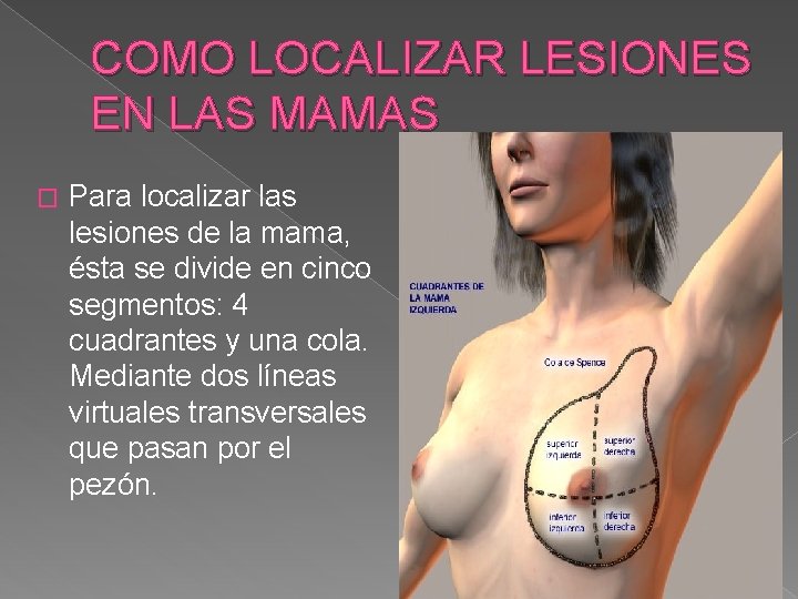 COMO LOCALIZAR LESIONES EN LAS MAMAS � Para localizar las lesiones de la mama,