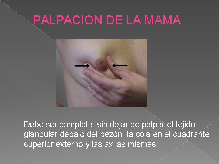 PALPACION DE LA MAMA Debe ser completa, sin dejar de palpar el tejido glandular
