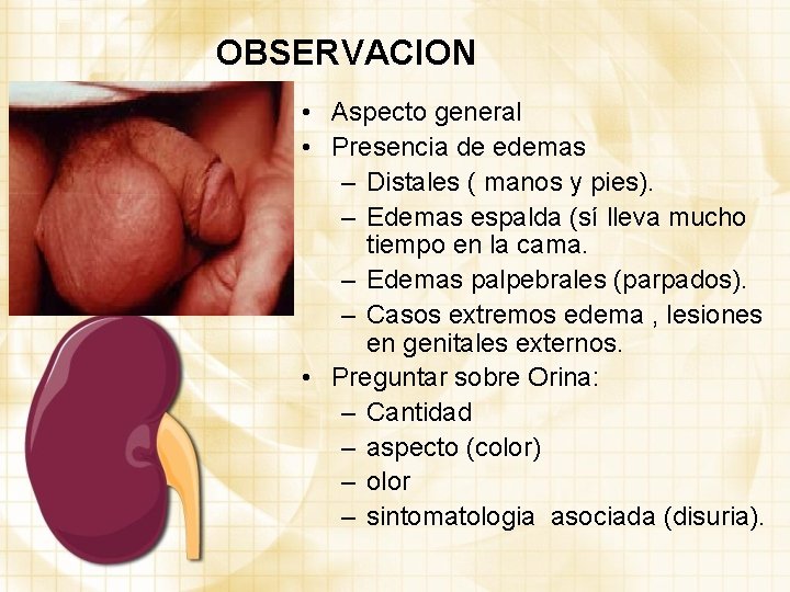 OBSERVACION • Aspecto general • Presencia de edemas – Distales ( manos y pies).