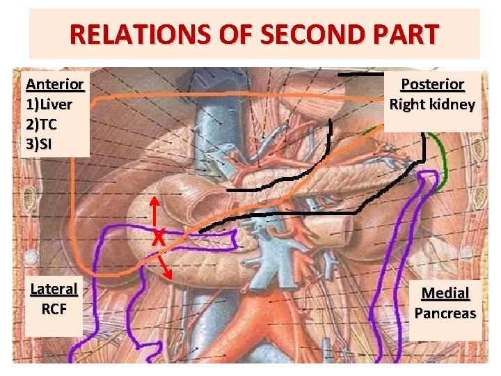 RELATIONS OF SECOND PART Anterior 1)Liver 2)TC 3)SI Posterior Right kidney X Lateral RCF