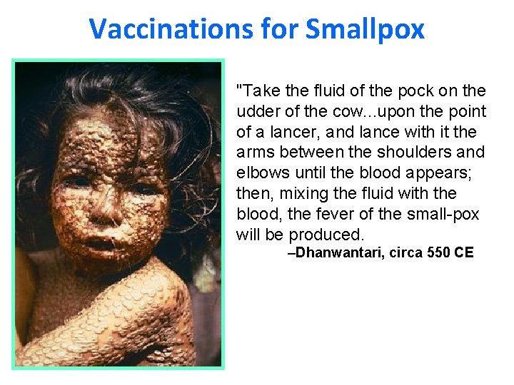 Vaccinations for Smallpox "Take the fluid of the pock on the udder of the