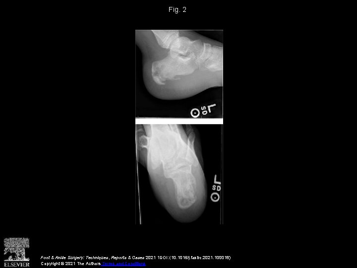 Fig. 2 Foot & Ankle Surgery: Techniques, Reports & Cases 2021 1 DOI: (10.
