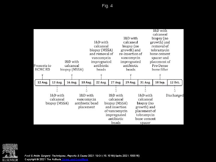 Fig. 4 Foot & Ankle Surgery: Techniques, Reports & Cases 2021 1 DOI: (10.