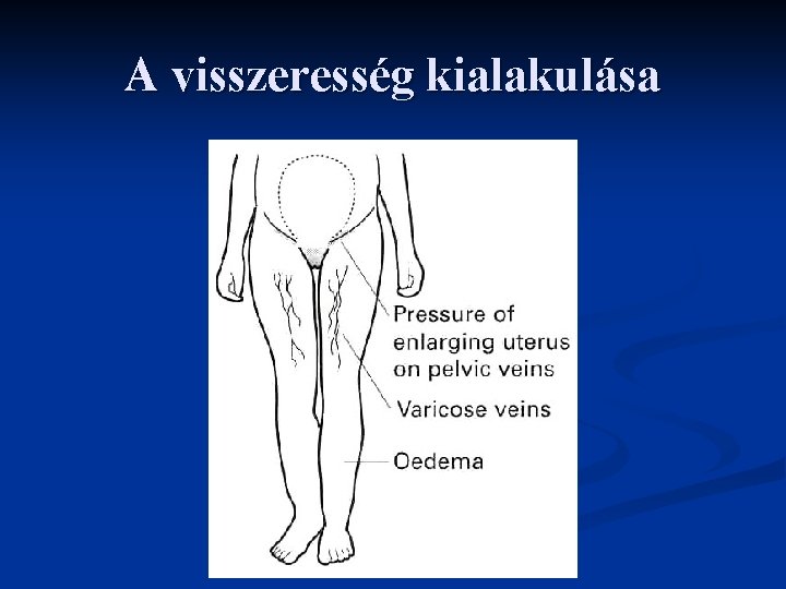 A visszeresség kialakulása 