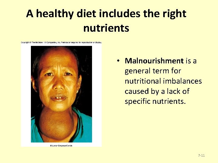 A healthy diet includes the right nutrients • Malnourishment is a general term for