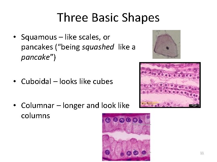 Three Basic Shapes • Squamous – like scales, or pancakes (“being squashed like a