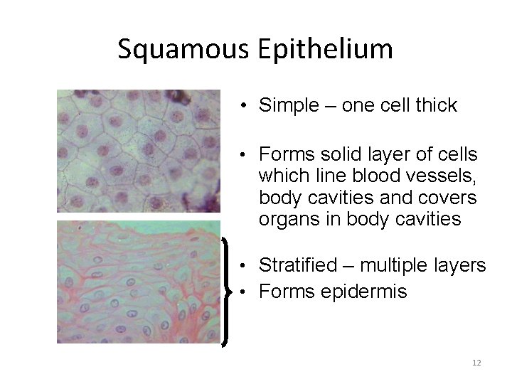 Squamous Epithelium • Simple – one cell thick • Forms solid layer of cells