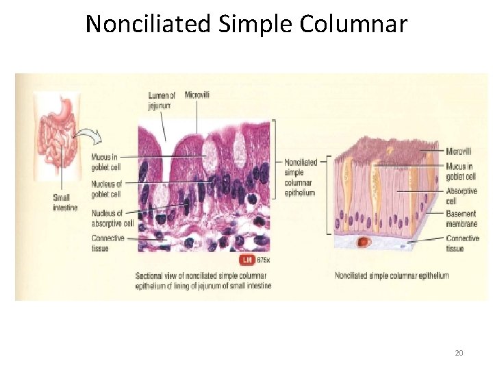 Nonciliated Simple Columnar 20 