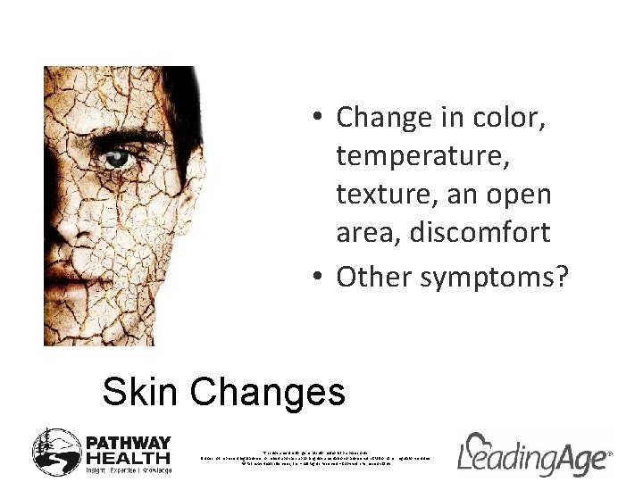 • Change in color, temperature, texture, an open area, discomfort • Other symptoms? • Change in color, temperature, texture, an open area, discomfort • Other symptoms?