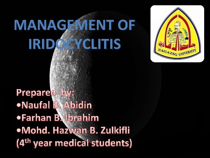 MANAGEMENT OF IRIDOCYCLITIS Prepared by: • Naufal B. Abidin • Farhan B. Ibrahim •