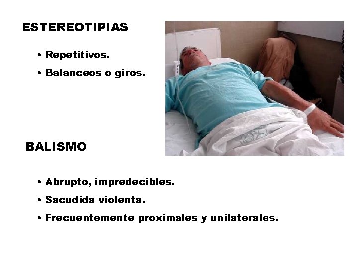 ESTEREOTIPIAS • Repetitivos. • Balanceos o giros. BALISMO • Abrupto, impredecibles. • Sacudida violenta.