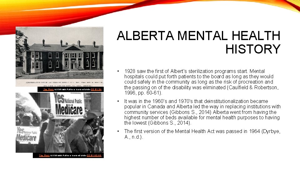 ALBERTA MENTAL HEALTH HISTORY • 1928 saw the first of Albert’s sterilization programs start.