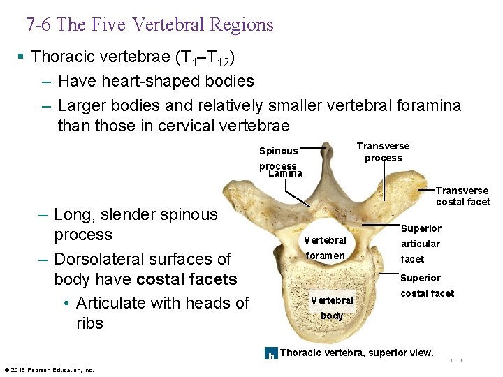 7 -6 The Five Vertebral Regions § Thoracic vertebrae (T 1–T 12) – Have