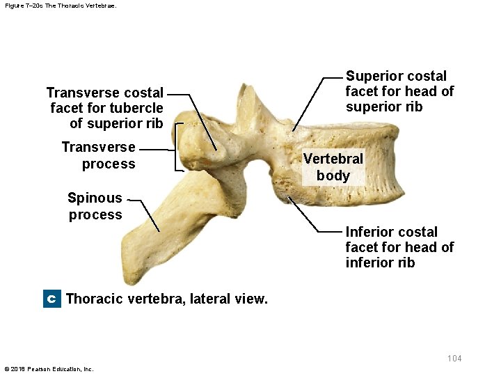 Figure 7– 20 c The Thoracic Vertebrae. Transverse costal facet for tubercle of superior