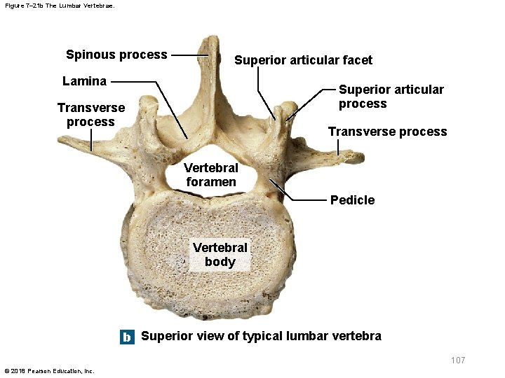 Figure 7– 21 b The Lumbar Vertebrae. Spinous process Superior articular facet Lamina Superior