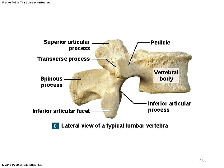 Figure 7– 21 c The Lumbar Vertebrae. Superior articular process Pedicle Transverse process Spinous