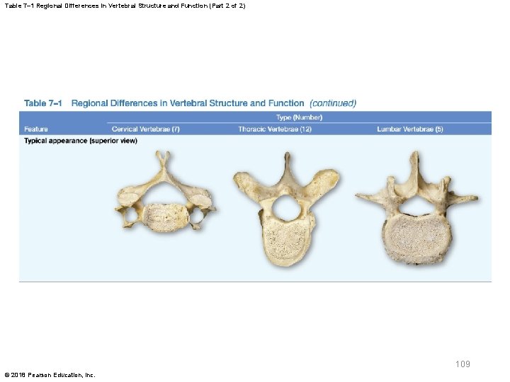 Table 7– 1 Regional Differences in Vertebral Structure and Function (Part 2 of 2)