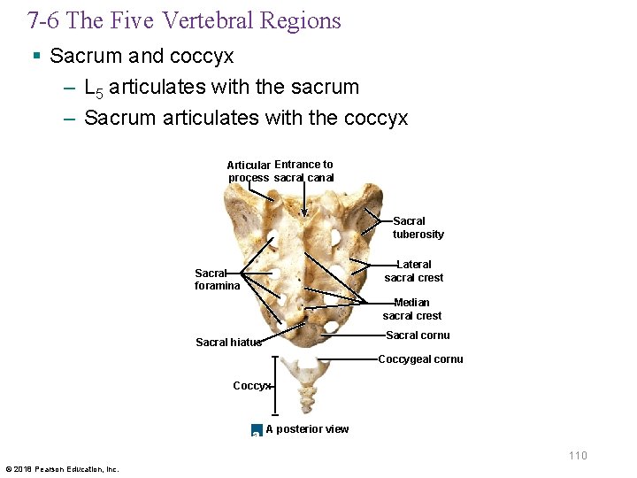 7 -6 The Five Vertebral Regions § Sacrum and coccyx – L 5 articulates