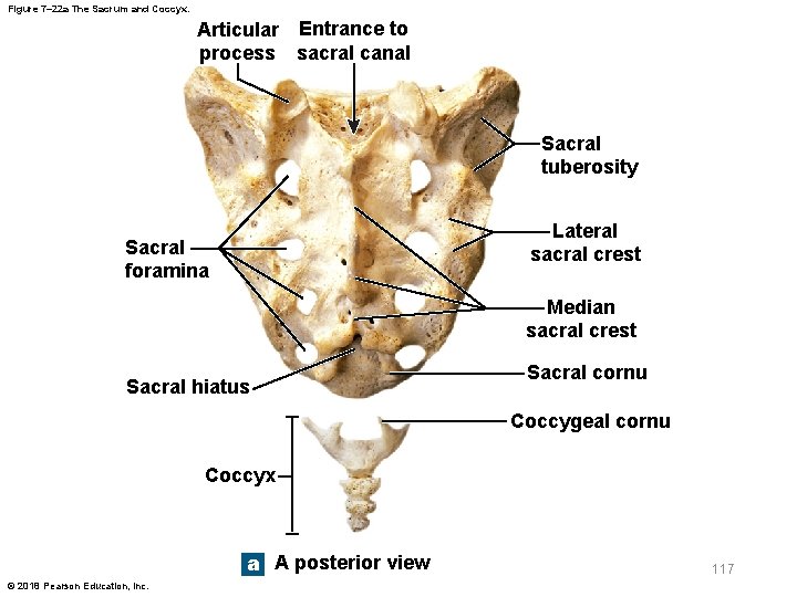 Figure 7– 22 a The Sacrum and Coccyx. Articular Entrance to process sacral canal