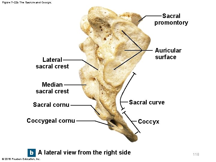 Figure 7– 22 b The Sacrum and Coccyx. Sacral promontory Auricular surface Lateral sacral