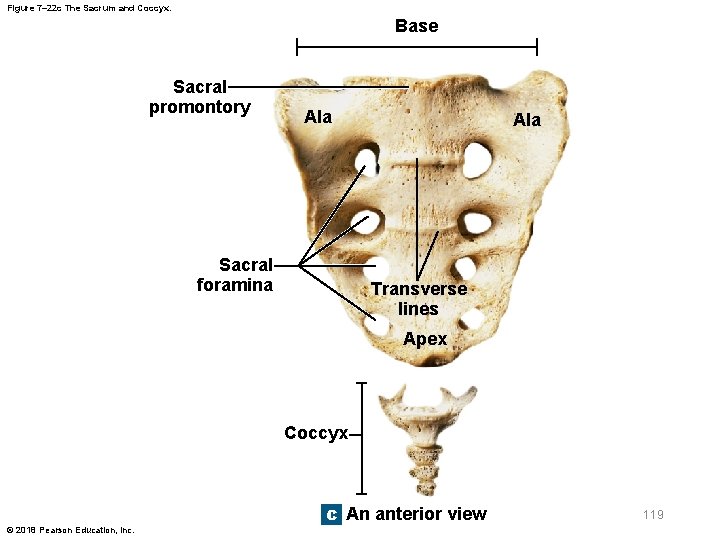 Figure 7– 22 c The Sacrum and Coccyx. Base Sacral promontory Ala Sacral foramina