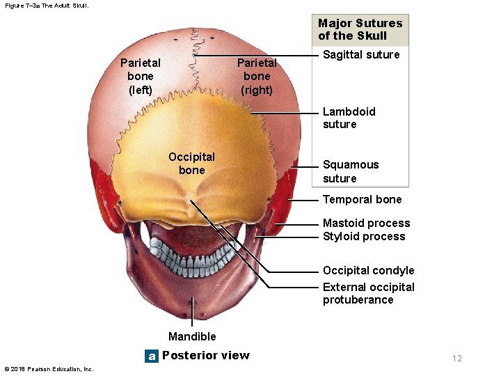 Figure 7– 3 a The Adult Skull. Major Sutures of the Skull Parietal bone