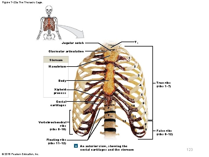 Figure 7– 23 a The Thoracic Cage. T 1 Jugular notch Clavicular articulation 1