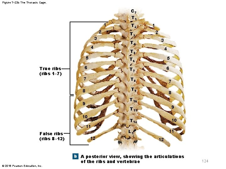 Figure 7– 23 b The Thoracic Cage. C 7 T 1 1 2 3