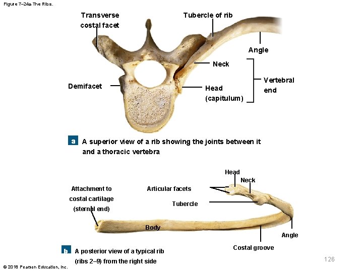 Figure 7– 24 a The Ribs. Transverse costal facet Tubercle of rib Angle Neck