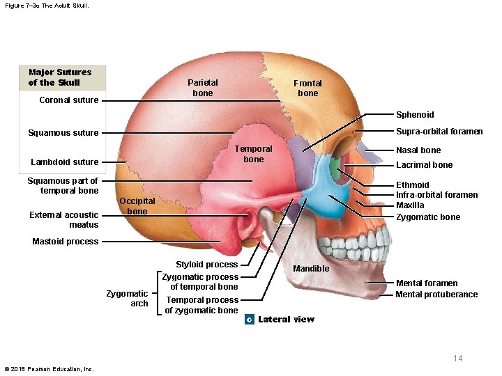 Figure 7– 3 c The Adult Skull. Major Sutures of the Skull Parietal bone