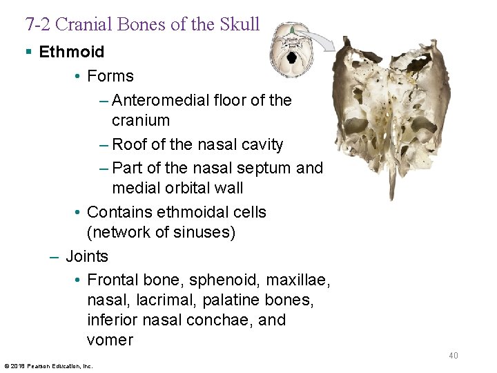 7 -2 Cranial Bones of the Skull § Ethmoid • Forms – Anteromedial floor