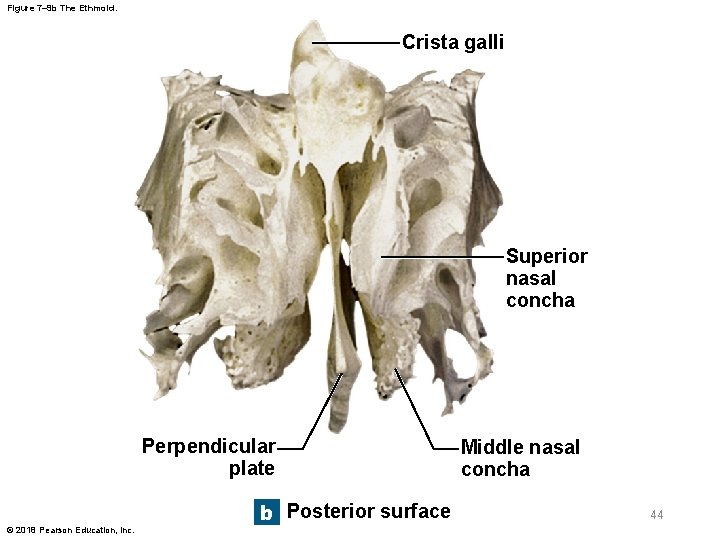 Figure 7– 9 b The Ethmoid. Crista galli Superior nasal concha Perpendicular plate ©