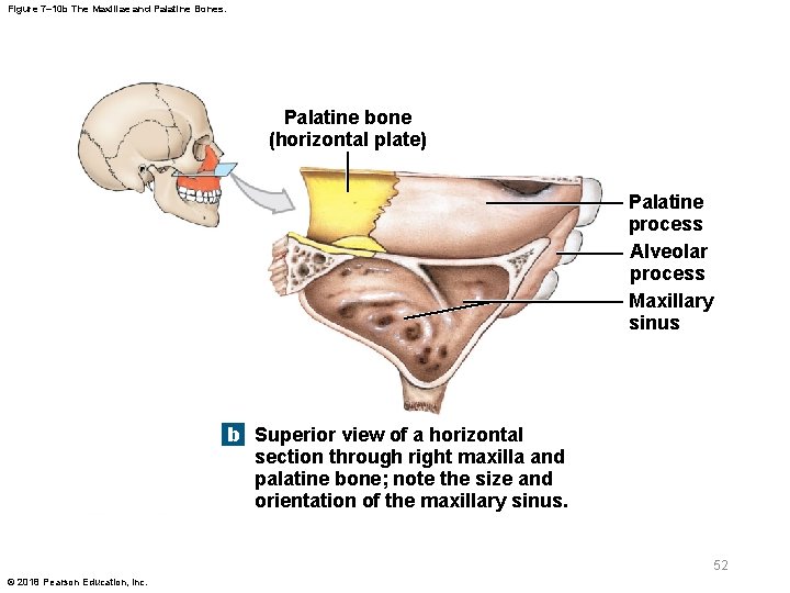 Figure 7– 10 b The Maxillae and Palatine Bones. Palatine bone (horizontal plate) Palatine