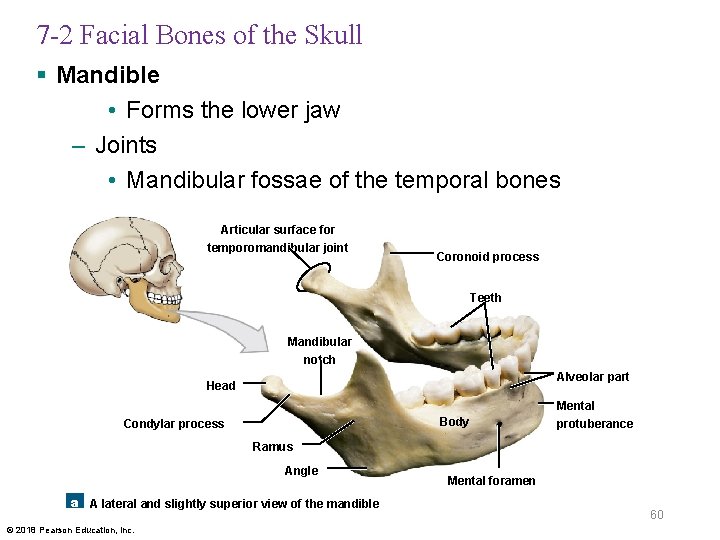 7 -2 Facial Bones of the Skull § Mandible • Forms the lower jaw