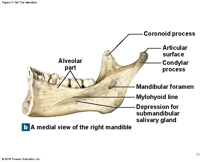 Figure 7– 12 b The Mandible. Coronoid process Alveolar part Articular surface Condylar process