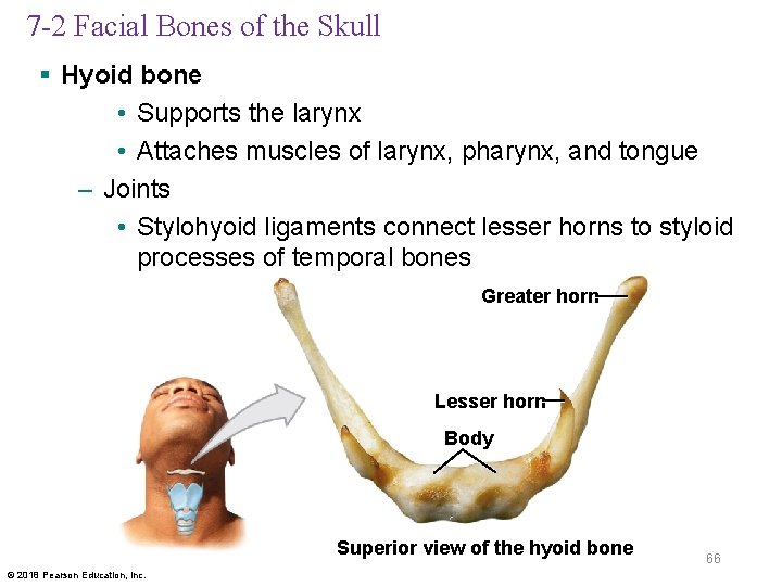7 -2 Facial Bones of the Skull § Hyoid bone • Supports the larynx