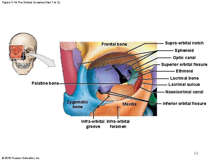 Figure 7– 14 The Orbital Complex (Part 1 of 2). Frontal bone Supra-orbital notch