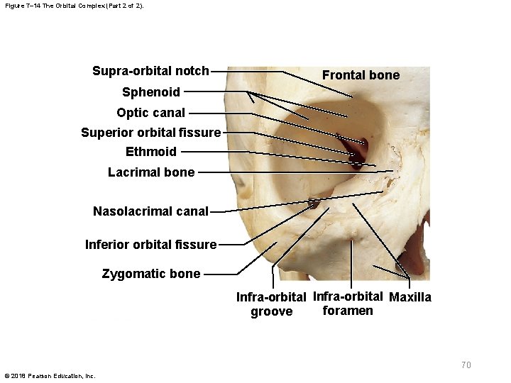 Figure 7– 14 The Orbital Complex (Part 2 of 2). Supra-orbital notch Frontal bone